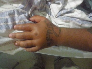 Migrante es atacado por una víbora en Juchitán