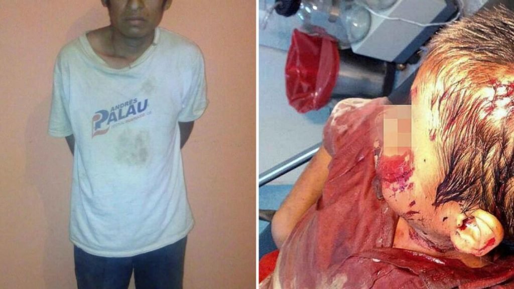 presentan-ante-mp-a-padre-que-macheteo-a-su-hijo