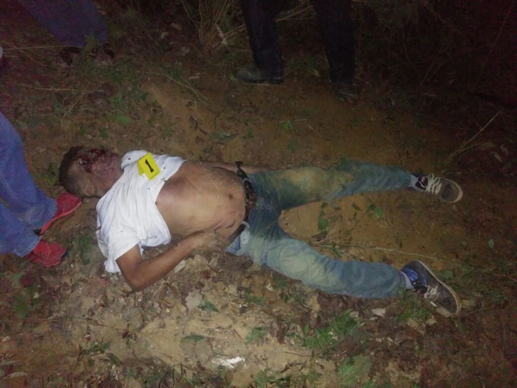 cadaver
