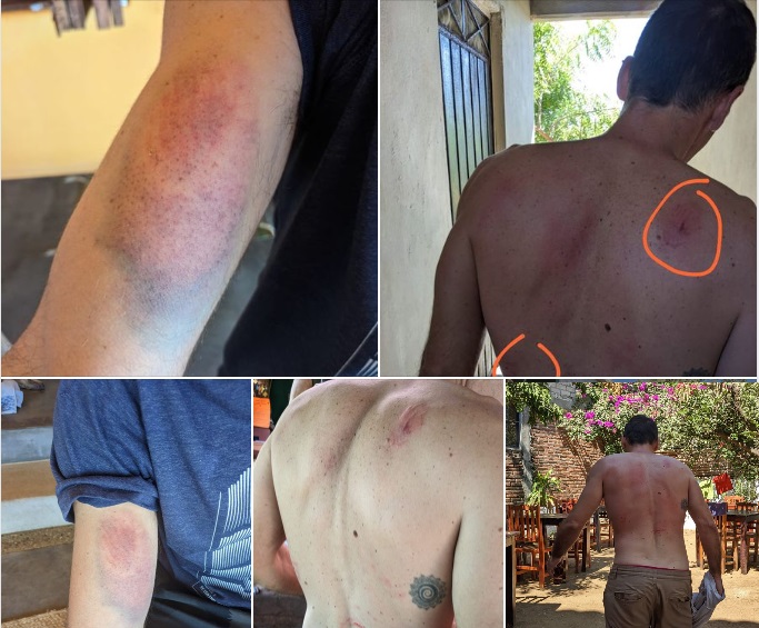 ITALIANO ES AGREDIDO POR CONNACIONALES; ATACANTES LO DIFAMAN EN REDES SOCIALES