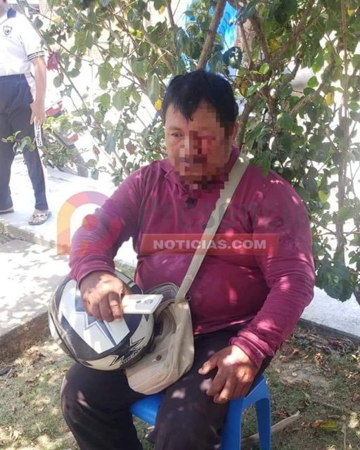Cobrador fue agredido por deudor, le sacó un ojo cuando llegó por el abono