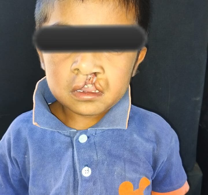 Discriminación en Miahuatlan