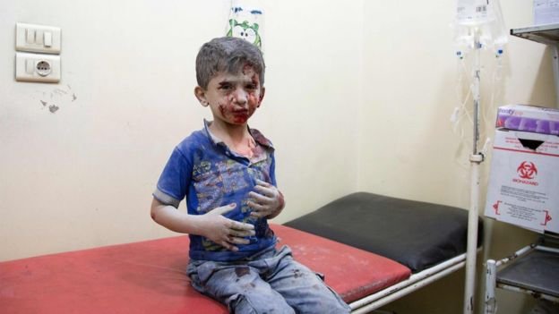 ¿Por qué la lucha por Alepo ha convertido esa ciudad siria en un infierno para los niños?