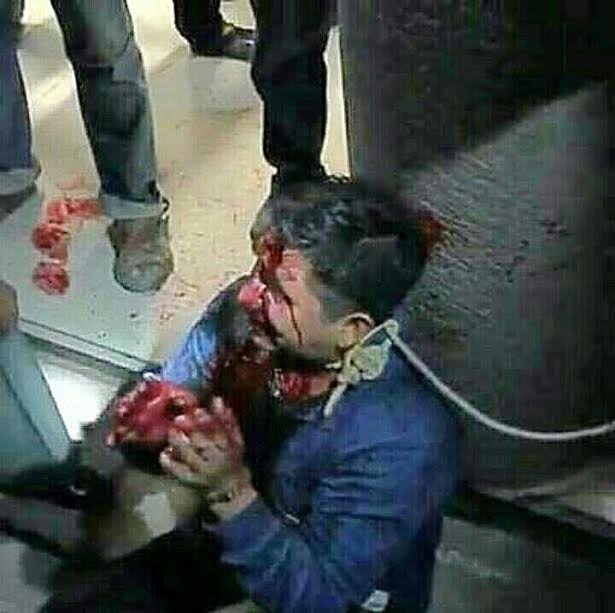 Un hombre fue golpeado, le quitaron tres dedos en Matatlan, Oaxaca