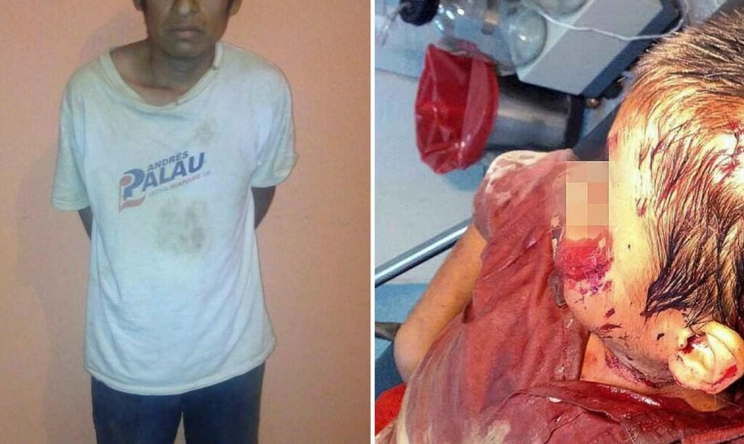 Presentan ante MP a padre que macheteo a su hijo