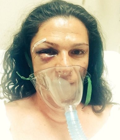 Sufre agresión Ana Guevara en autopista de México