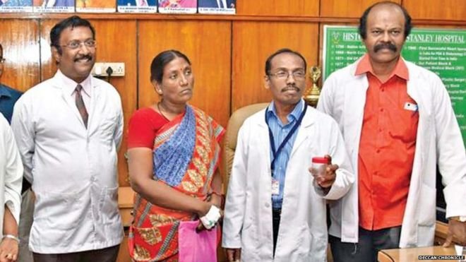 “Notaba algo que se movía”: la mujer que tenía una cucaracha viva dentro de su cabeza