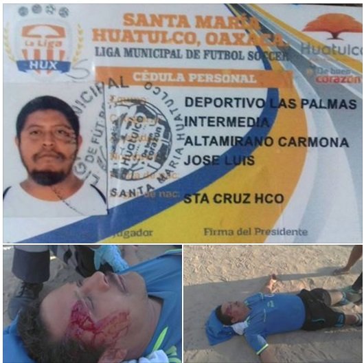 Golpean salvajemente a árbitro en partido de futbol