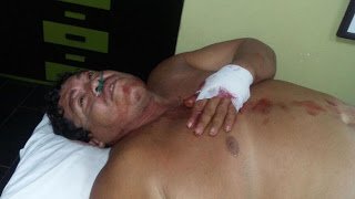 Pescador de Colotepec es atacado por un cocodrilo