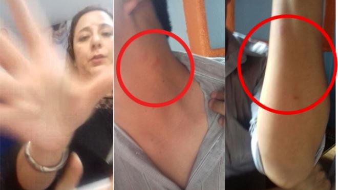 Funcionaria de Murat agrede y llama a médico “muerto de hambre”