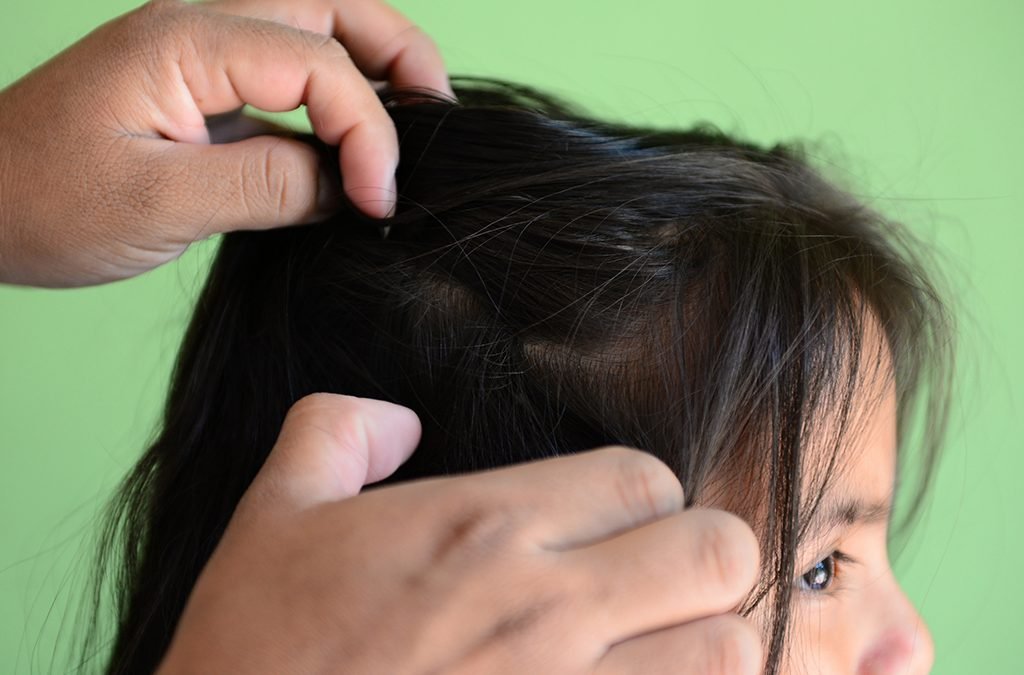 Revisión constante para detectar brotes de piojos: SSO