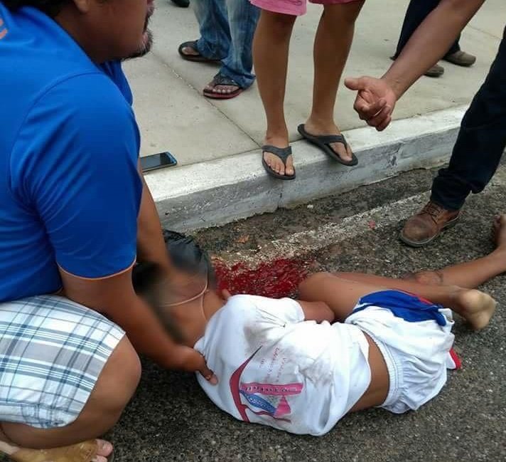 Atropellan a menor en Santa María Huatulco
