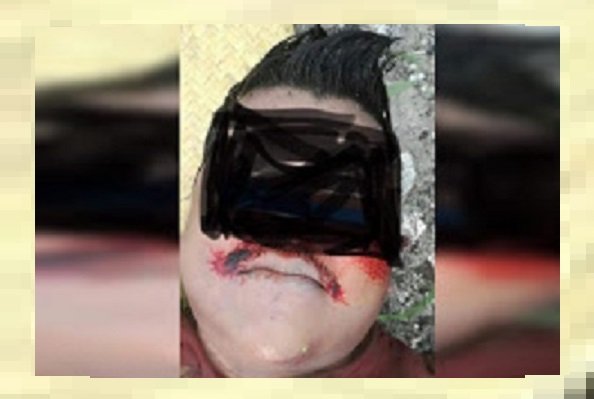 Violan Y Ejecutan A Joven De 22 Años En Pinotepa