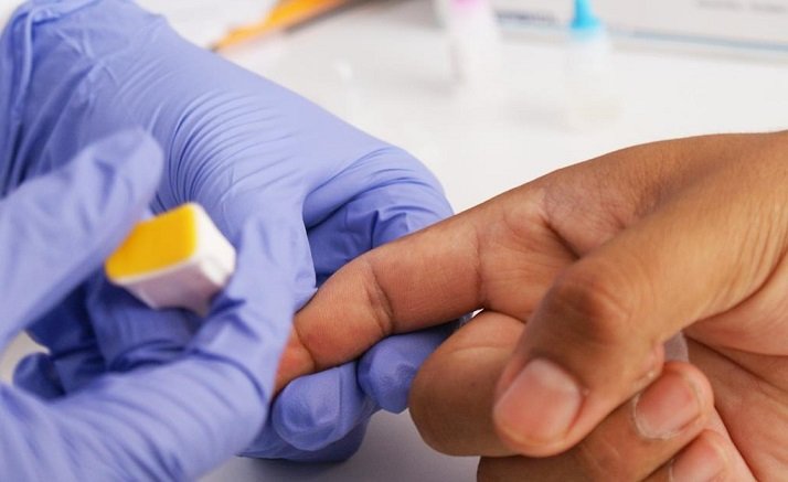 Prevención y detección del VIH y Sida, trabajo permanente de Coesida- CAPASIST