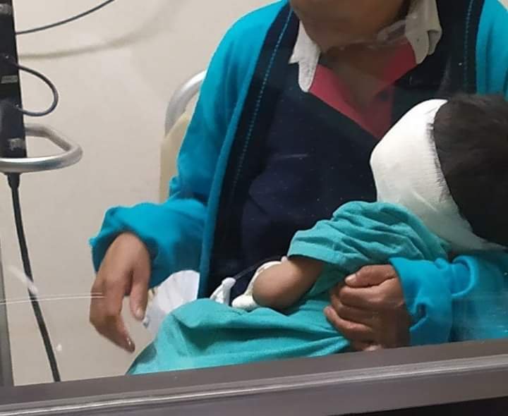 Fortalece SSO atención médica a pequeño que presenta tumoración en ojo izquierdo