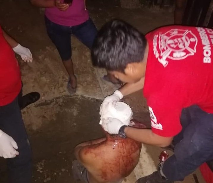 Lesionan a vecino de El Zapote, Huatulco