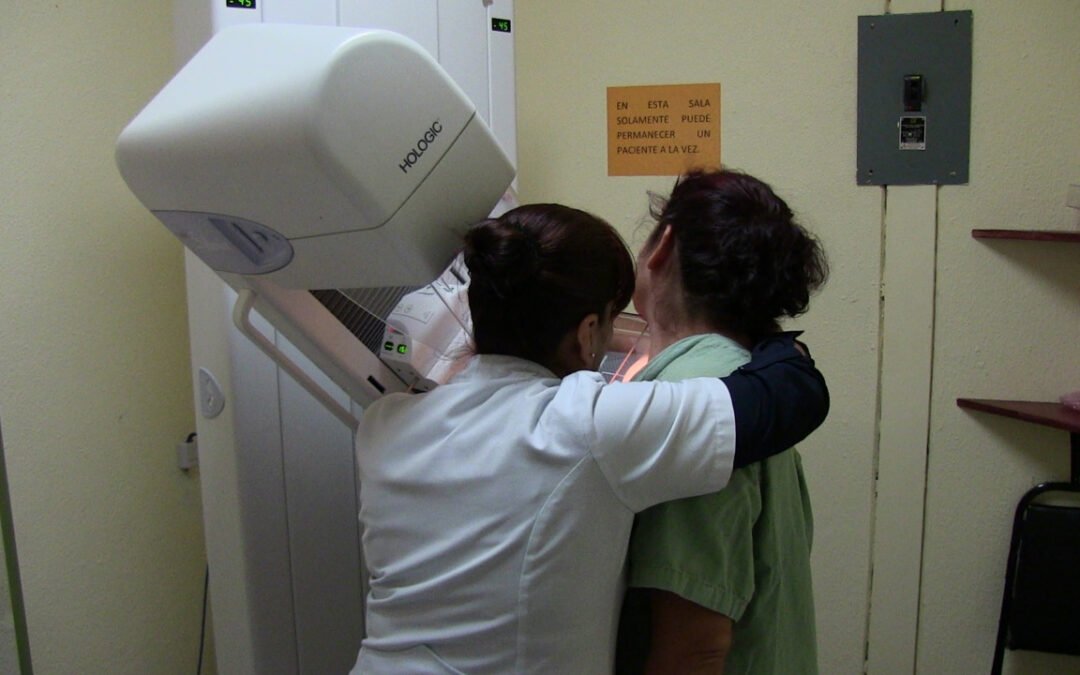 Autoexploración de senos, ayuda a detectar a tiempo el Cáncer de Mama