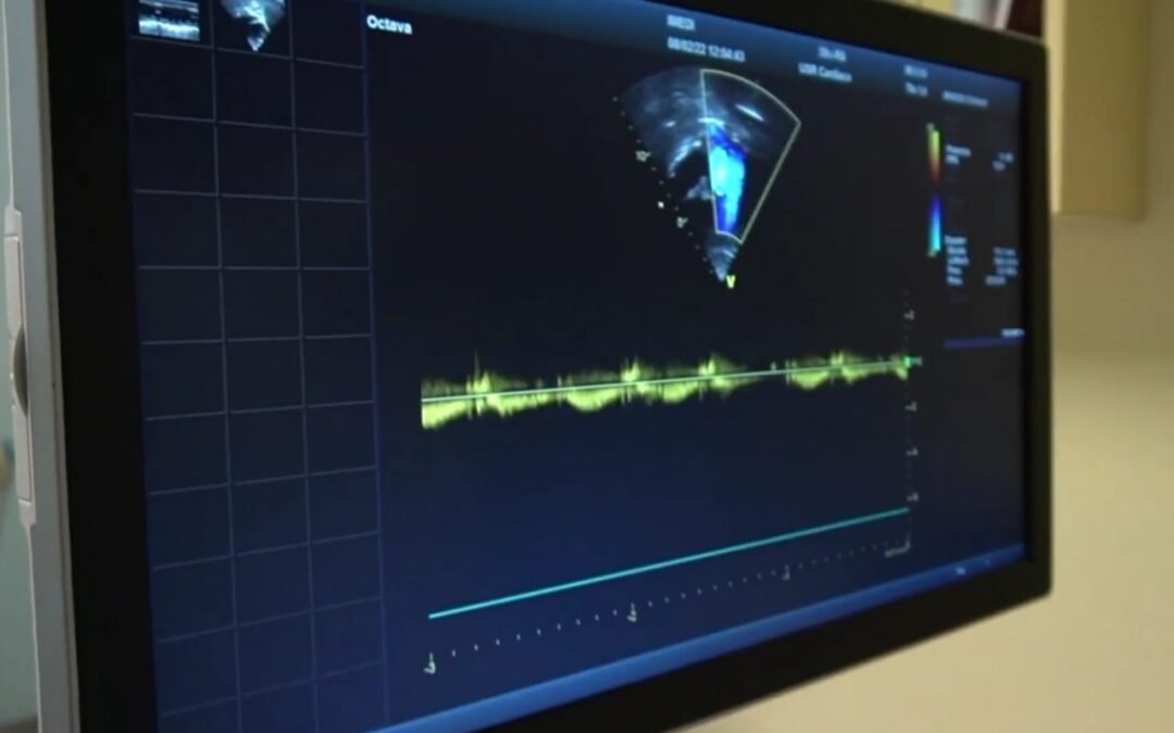 El diagnóstico oportuno, mejora la calidad de vida en pacientes con Cardiopatías Congénitas