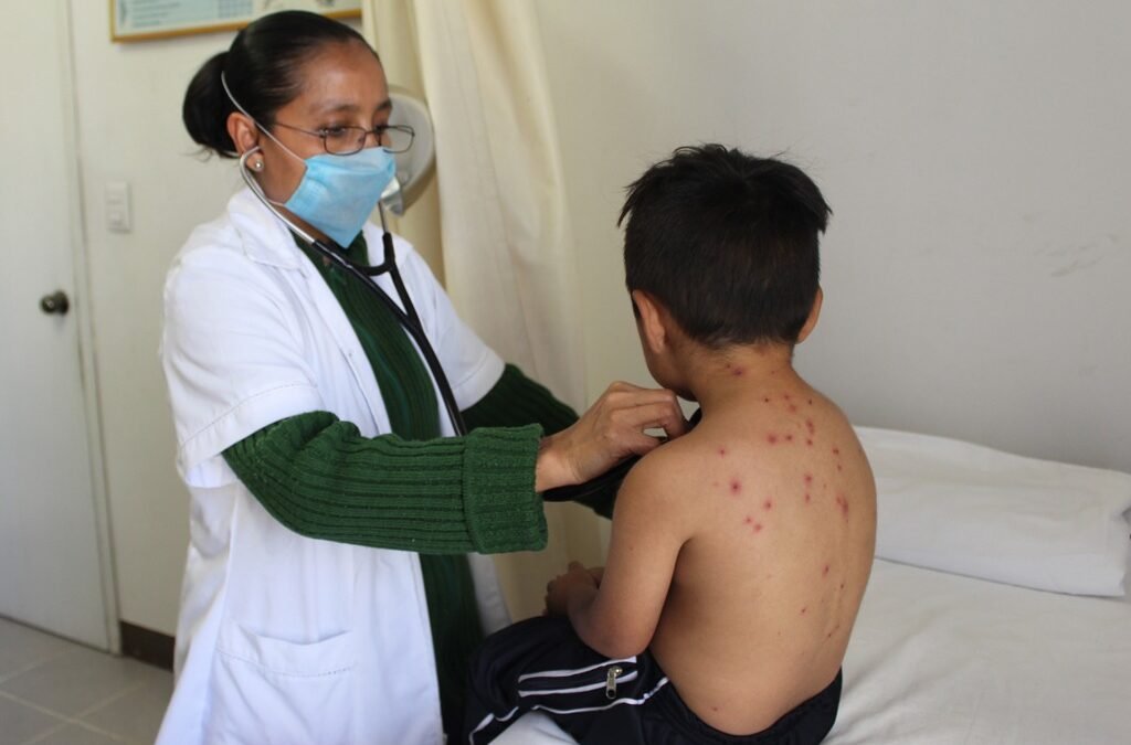 Cuantifica Oaxaca baja incidencia de casos de varicela: SSO