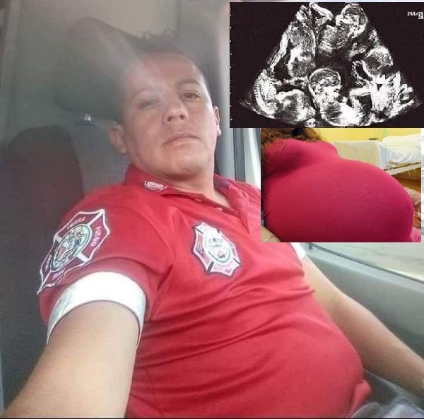 A pesar de que ya tiene seis hijos, la esposa de un bombero de Ixtapaluca dará a luz a 13 bebés en los próximos días,