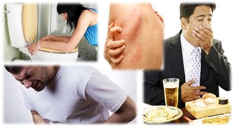 Atienden los SSO brote por intoxicación alimentaria